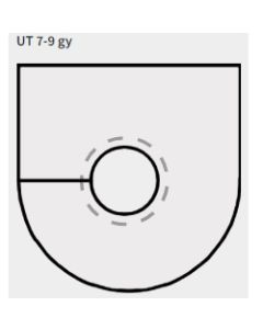 56004 | UT 7-9 gy| Split U Grommets